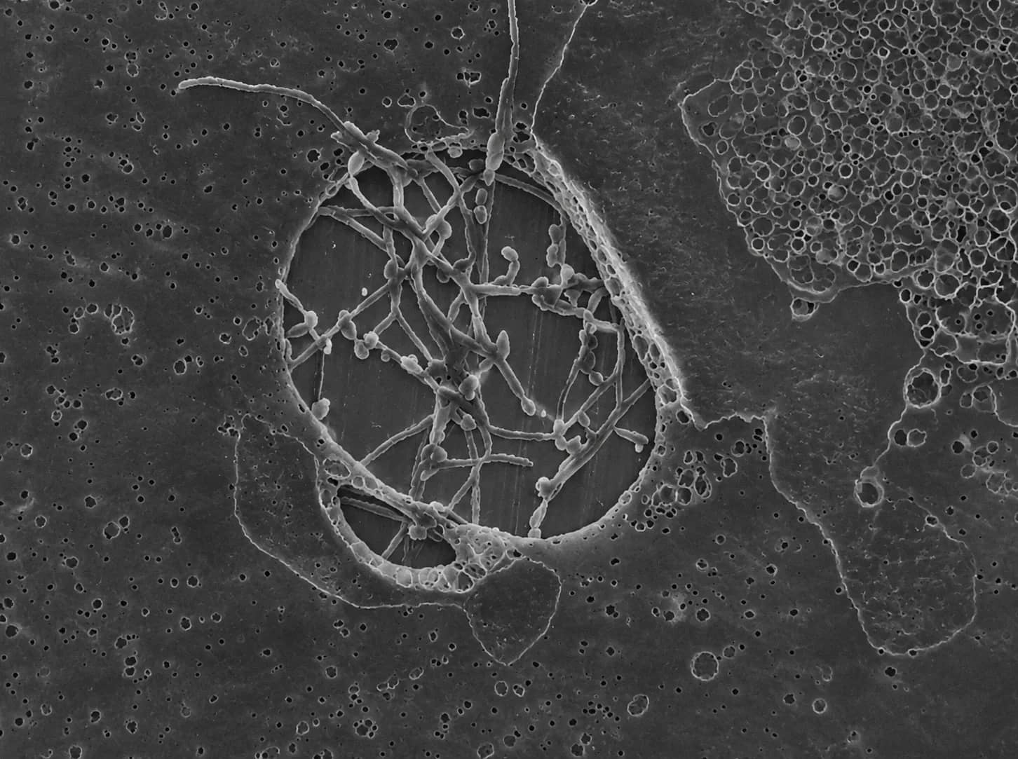 Electron micrograph of yeast cells and filamentous structures